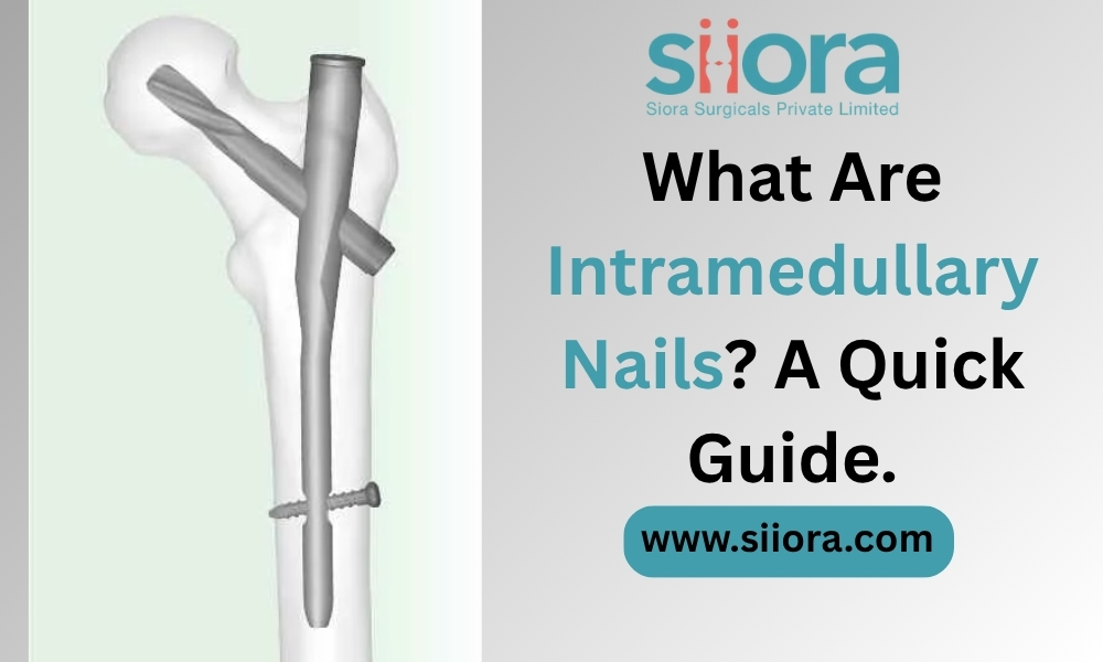 What Are Intramedullary Nails? A Quick Guide.