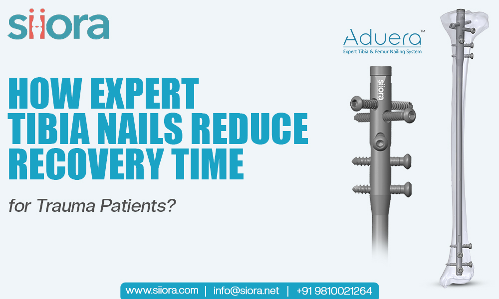 How Expert Tibia Nails Reduce Recovery Time for Trauma Patients?