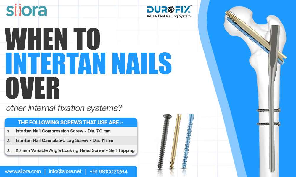 When to Intertan Nails over other internal fixation&nbsp;systems?